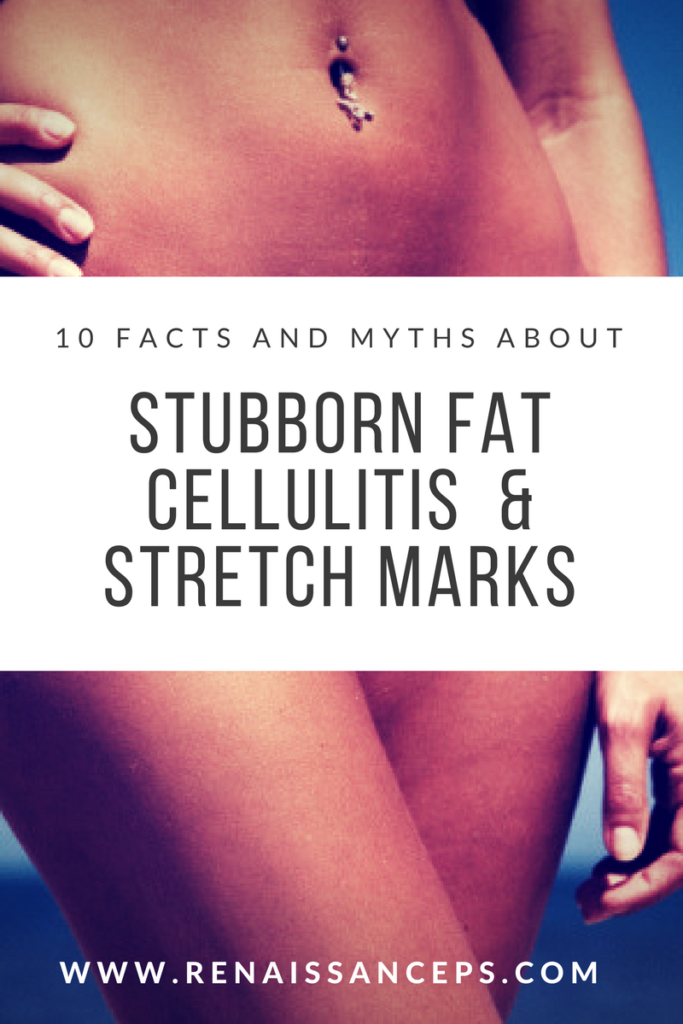 fat-cellulite-stretch-marks